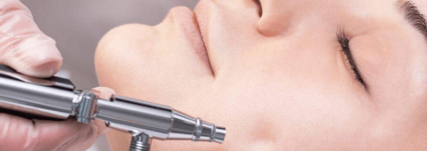 Beneficios que ofrece el tratamiento facial avanzado Jet Peel